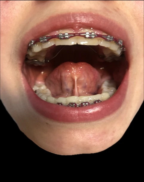 terapia logopedyczna Warszawa Rehastom